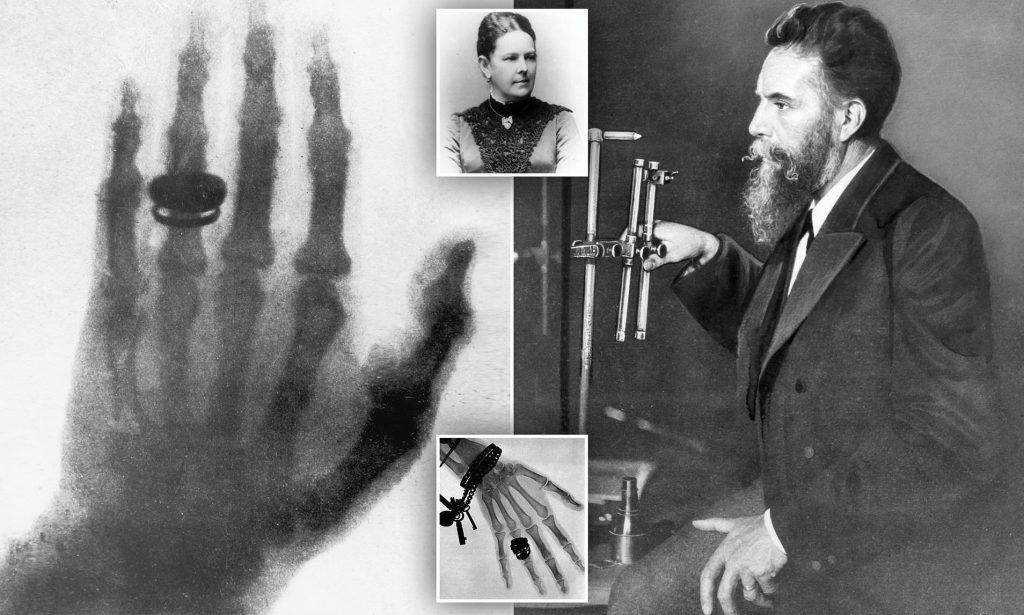 From Shadows to Nobel Glory: Wilhelm Röentgen’s X-Ray Legacy Transcends Time