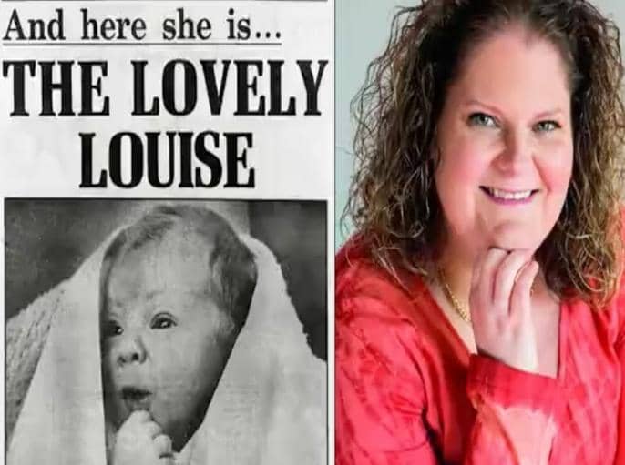 The Birth of Louise Brown: Celebrating 45 Years of In Vitro Fertilization