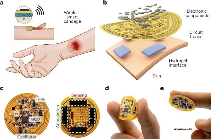 Revolutionizing Wound Care: The Promise of Smart Bandages